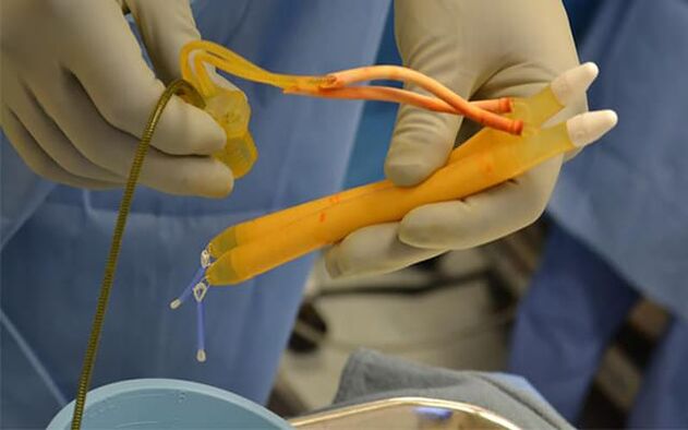 Implantate im Penis